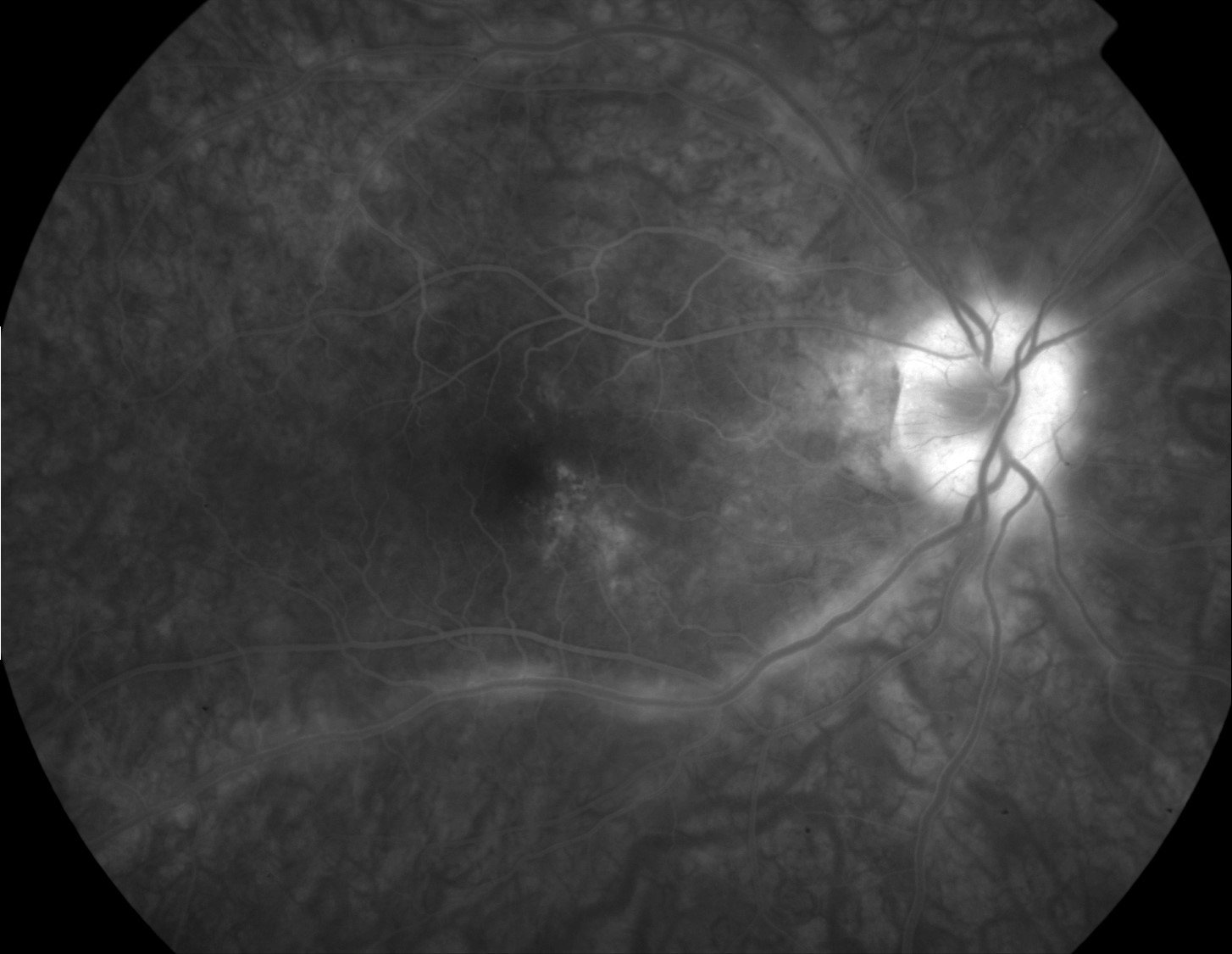 Image 2b
