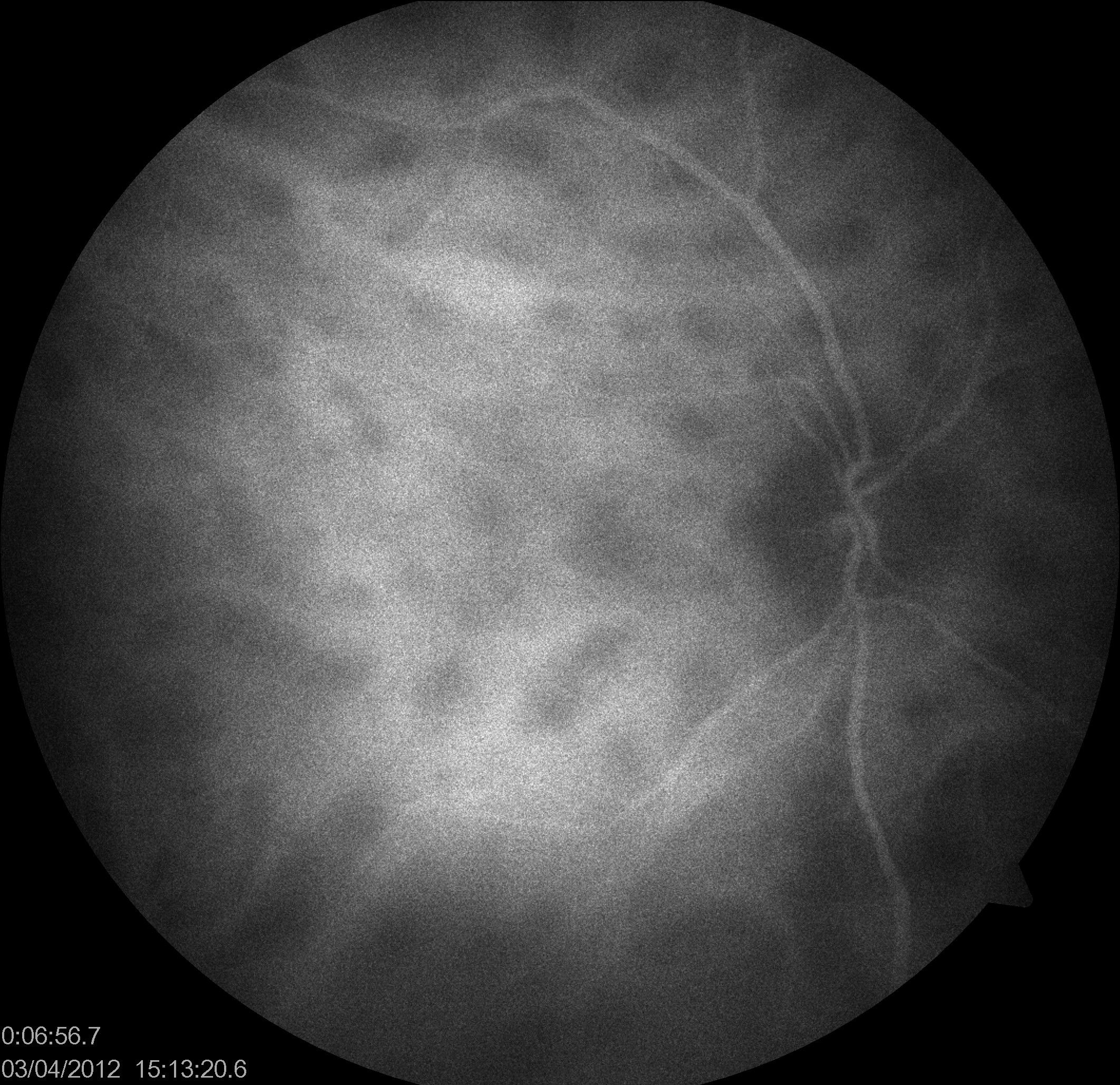 Image 3c
