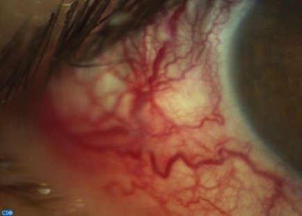 Image 1b