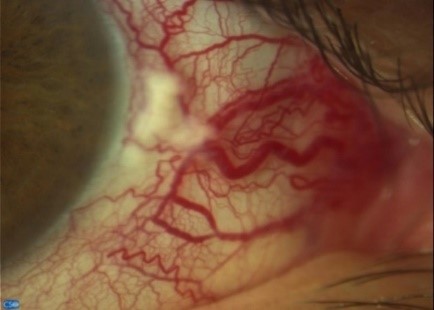 Image 1c