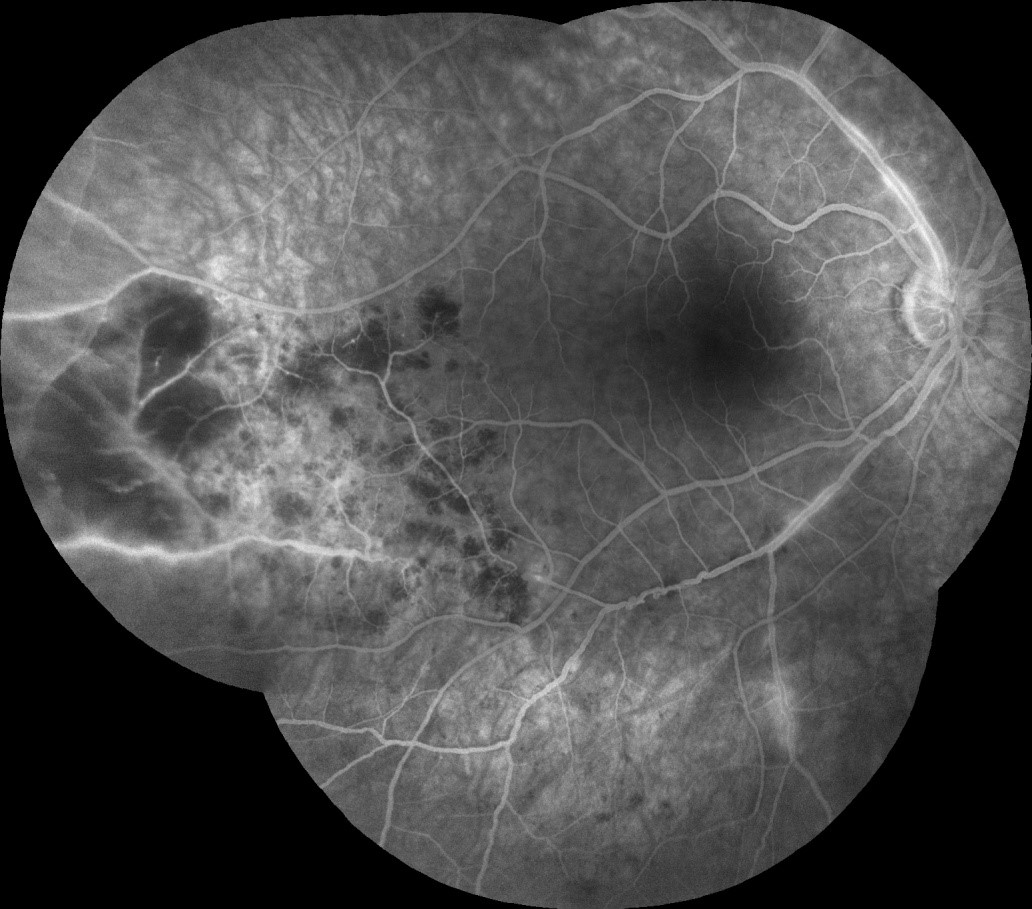 Image A1b