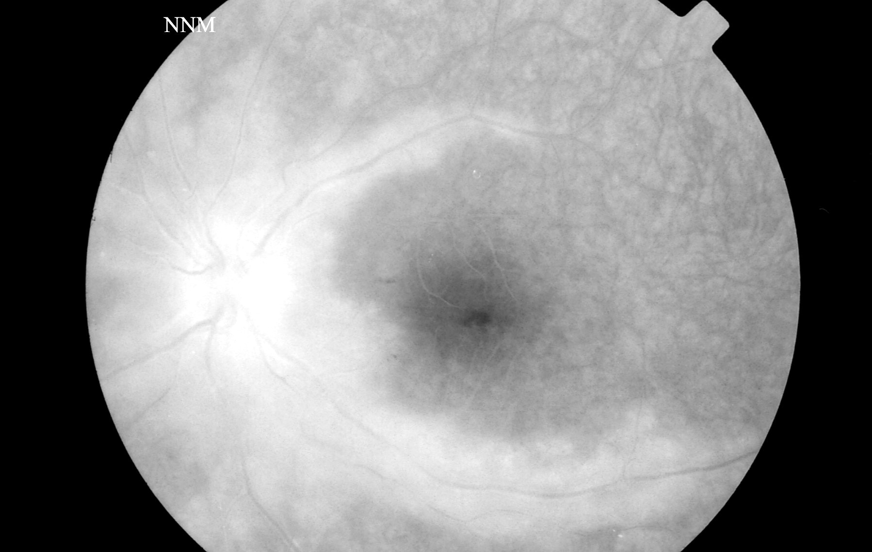 Image A1c