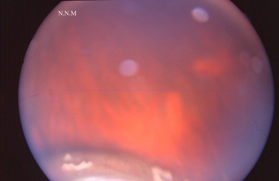 Image 1e